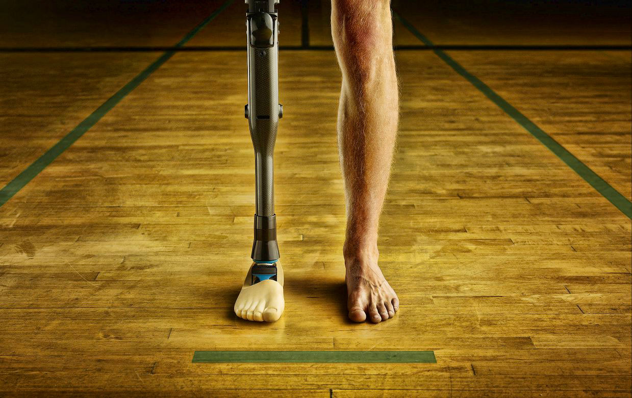 International, kaki palsu penyandang disabilitas: Lamborghini Bawa Carbon Fiber Untuk Dipasang di Tubuh Manusia!