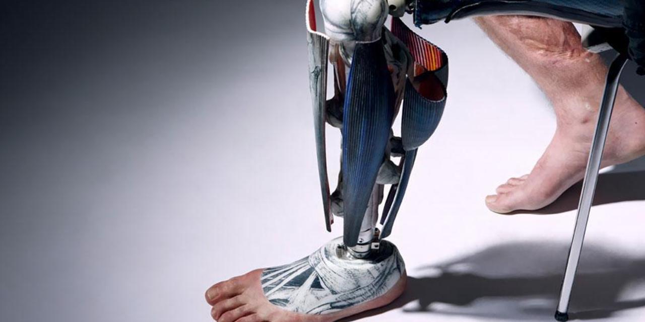 International, fake leg for medical purpose: Lamborghini Bawa Carbon Fiber Untuk Dipasang di Tubuh Manusia!